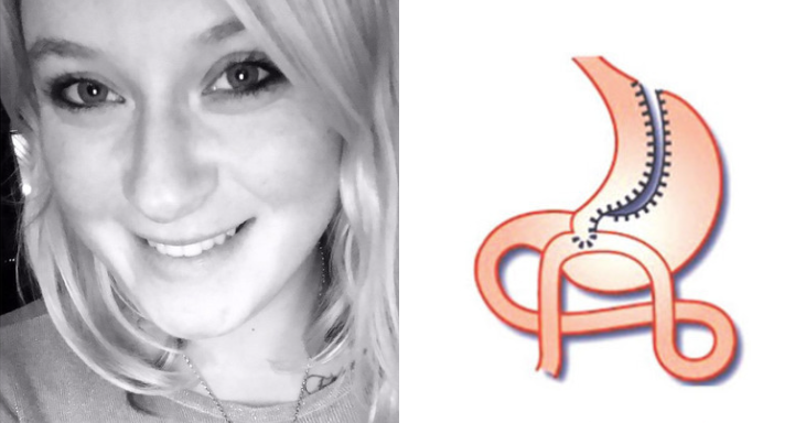 Jana, 25 ans, décède après son opération bypass pour maigrir : elle devait se marier