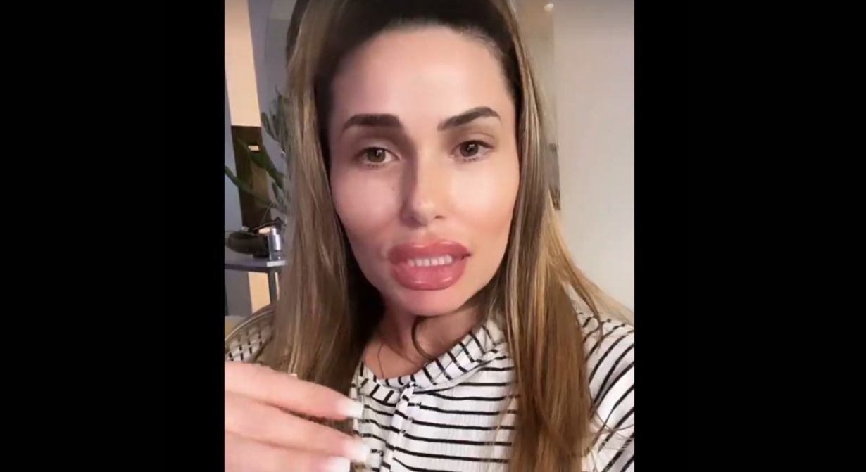 Capucine Anav transformée : « Je n’ai pas pu résister à faire de la chirurgie »